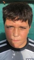 ANDER